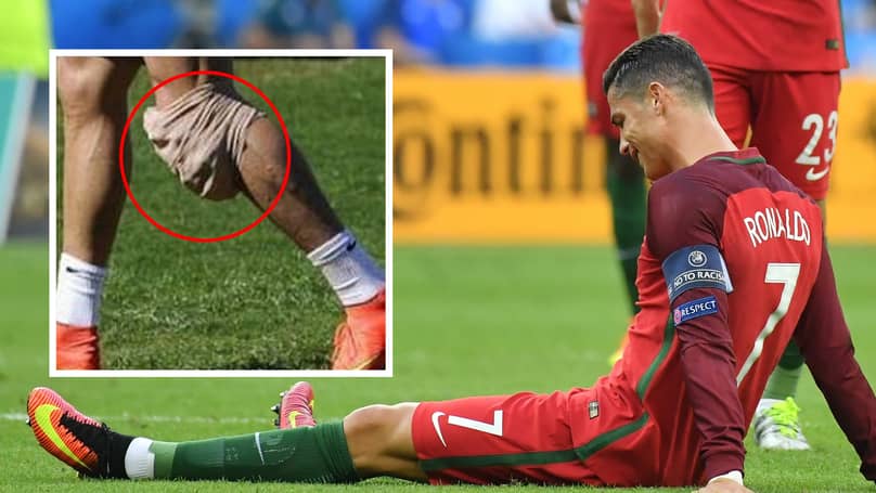 Cristiano Ronaldo's Injury "Nothing" Serious After He Missed Out On Manchester United's FA Cup Victory