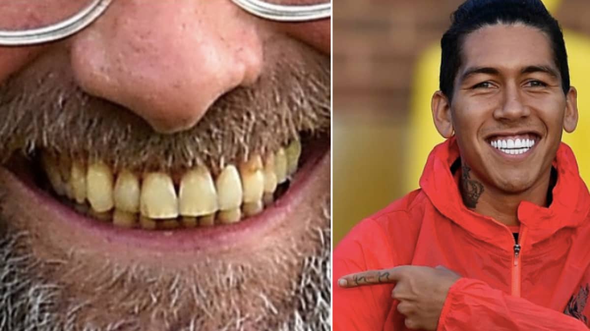 Jurgen Klopp Has New Teeth And They're Brighter Than A Thousand Suns -  SPORTbible
