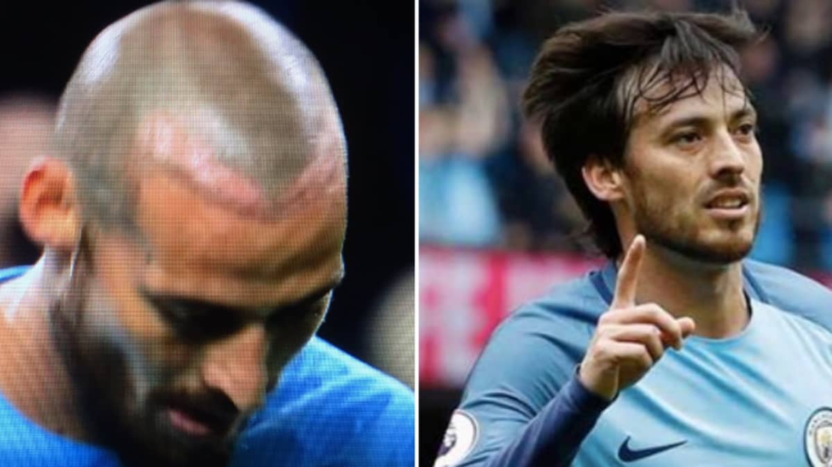 David Silva Has Suddenly Grown Some Hair And People Are Asking Questions -  SPORTbible