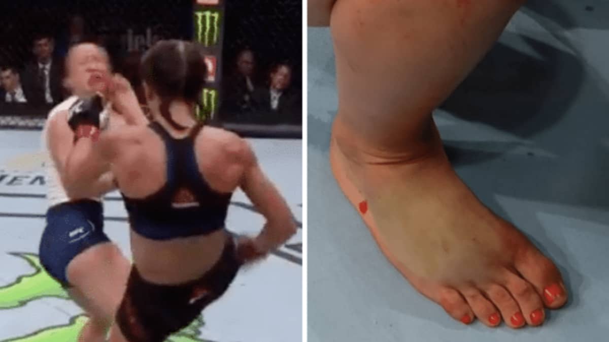 UFC Fighter Joanna Jedrzejczyk Suffers Broken Foot And Somehow Manages To C...
