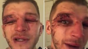 Dan Hooker's Face Was An Absolute Mess After Five Round War With Dustin Poirier