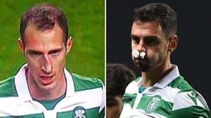 André Pinto And Radosav Petrovic Both Break Their Noses Against Porto
