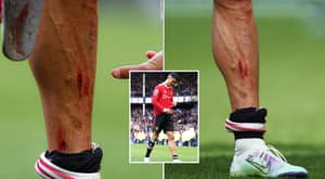 Cristiano Ronaldo Shows Off Bloodied Leg After Final Whistle, Reveals Gruesome Stud Mark