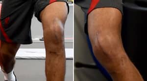 Liverpool Defender Joe Gomez Shows Off Massive Knee Scar Post-Surgery