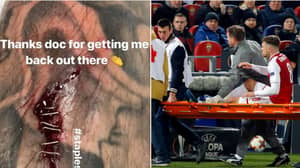 Aaron Ramsey Posts Picture Of His Stapled Leg Injury And Everyone Is Freaking Out 