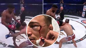 When Paul Daley Destroyed Brennan Ward With A Flying Knee That Ruined His Face