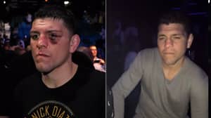 The Time Nick Diaz Destroyed Nightclub Thug With 'Elbows' And 'Knees' 