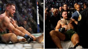 Conor McGregor Undergoes 'Successful' Surgery After Breaking Leg At UFC 264