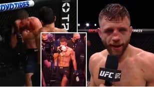 The Brutal Injuries Calvin Kattar Suffered In His Five-Round Beating To Max Holloway
