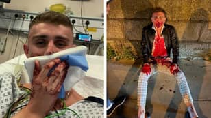 Olympian Jack Woolley Left Bloodied And Needing Surgery After Violent Gang Attack