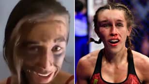 Joanna Jedrzejczyk Releases Video Showing Her 'Many Bruises' After Horrific Injury Vs Zhang Weili