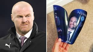 Chelsea Player Has Sean Dyche’s Face On His Shin Pads And It’s Incredible