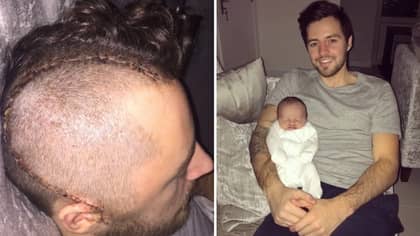 Ryan Mason Shares Image Of Shocking Scar Following Fractured Skull Suffered Last Year