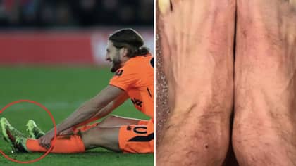 Adam Lallana Posts Picture Of His Frozen Toes And Everybody Is Seriously Freaking Out 