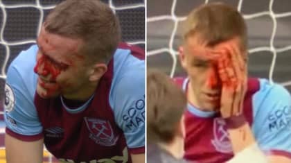 Tomas Soucek Involved In Nasty Collision, Smiles And Carries On Like An Absolute Warrior 