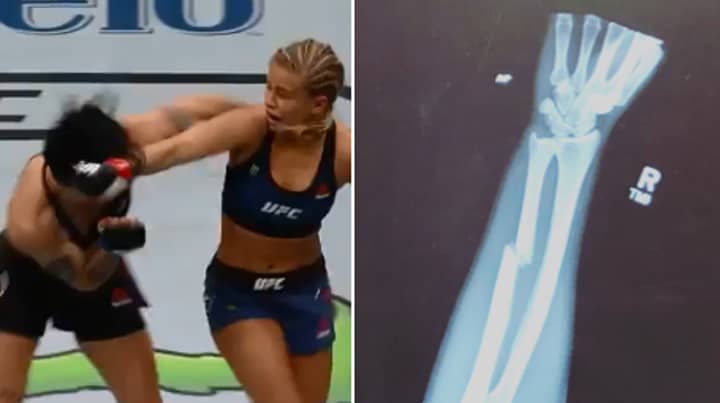 Watch: Paige VanZant Suffers Gruesome Arm Break After Throwing Spinning Backfist 