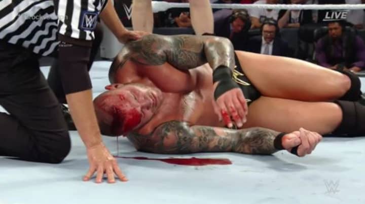 WATCH: Brock Lesnar Leaves Randy Orton A Bloody Mess At SummerSlam