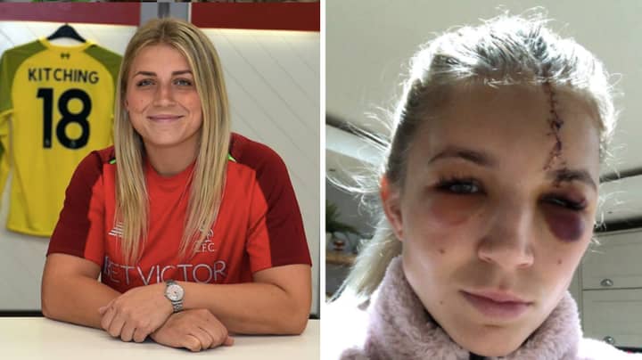 Liverpool Women's Goalkeeper Fran Kitching Shows Off Horrific Injury On Social Media
