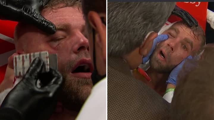 Billy Joe Saunders Will Be Out For A 'Long, Long Time' After Busted Eye Socket Injury 
