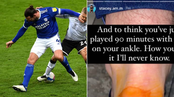 Cardiff Defender Sean Morrison Played With 'Half His Heel Missing' As He Shows Off Grim Injury