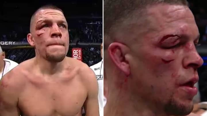 Nate Diaz Suffers Two Nasty Cuts In Loss To Jorge Masvidal At UFC 244