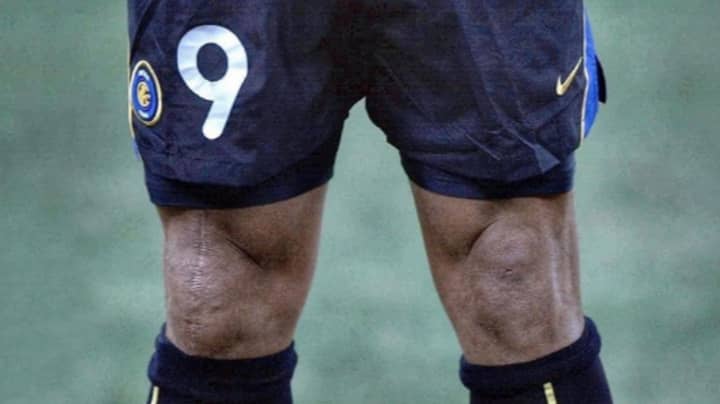 Ronaldo's Knees Stopped Him From Breaking Every Record In Football History 