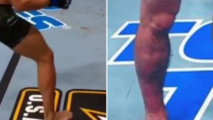 The Moment Conor McGregor's Leg Buckled Vs Dustin Poirier 