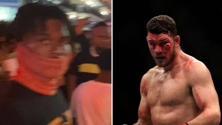Michael Bisping Reveals He Was Assaulted On Saturday Night